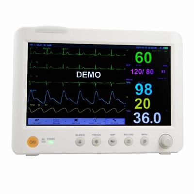 ECG/NIBP Portable Multi Parameter Patient Monitor Untuk Penyimpanan Data Internal Rumah Sakit