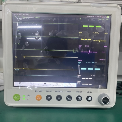 Monitor Pasien Multi Parameter Portabel dengan Konektivitas Kabel/Nirkabel