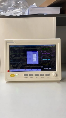 Medical 10.1 inci Monitor Pasien Portable Multi-Parameter Monitor Pasien