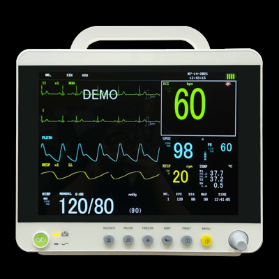 Monitor Pasien Neonatal Elektrik yang Disediakan Pabrik dengan Fitur Multi-Parameter untuk Departemen Pediatri Rumah Sakit