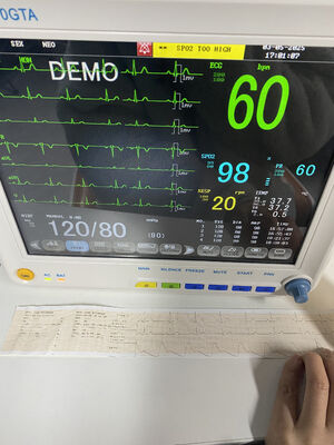 Monitor samping tempat tidur portabel dengan EKG SPO2 NIBP TEMP RESP Opsional ETCO2-Kelas II Garansi 1 Tahun